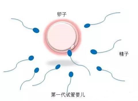 国内试管供卵代孕